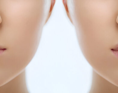 lip lift